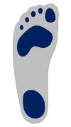 Hohlfuß - Left