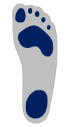 Hohlfuß - Right