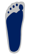 Plattfuß - Left
