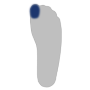 Großzehe