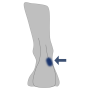 Innenknöchel