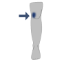 Knie-Schmerz Innen