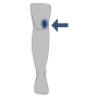 Knie-Schmerz Innen