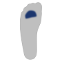 Mittelfußköpfchen II-V