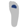 Mittelfußköpfchen II-V