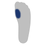 Mittelfußköpfchen I