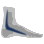 Tibialis Posterior Syndrom