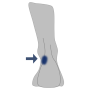 Außenknöchel