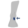 Außenknöchel